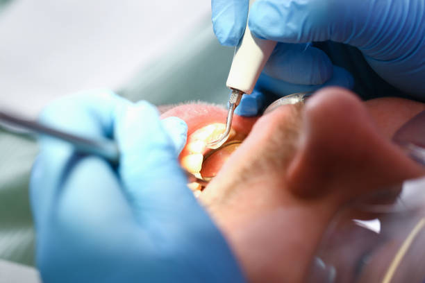 Best Emergency Dental Care for Trauma or Injury in Chappaqua, NY